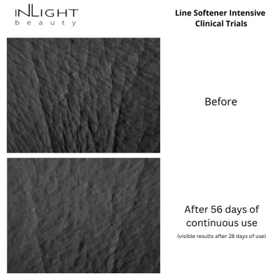 Antirughe - LINE SOFTNER intensive formula 15 ml -Inlight Beauty